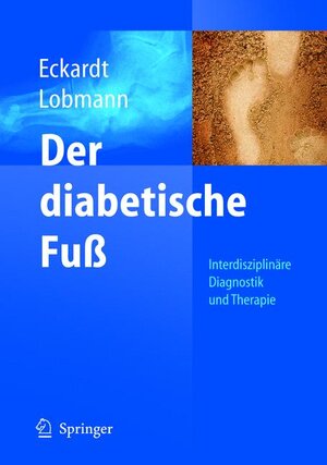 Buchcover Der diabetische Fuß | Anke Eckardt | EAN 9783540227199 | ISBN 3-540-22719-9 | ISBN 978-3-540-22719-9