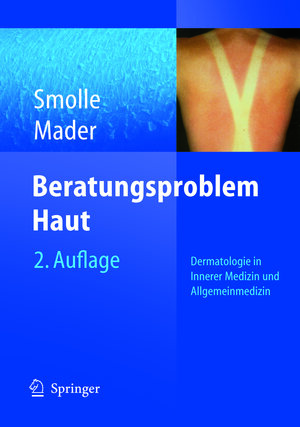 Buchcover Beratungsproblem Haut | Josef Smolle | EAN 9783540268970 | ISBN 3-540-26897-9 | ISBN 978-3-540-26897-0