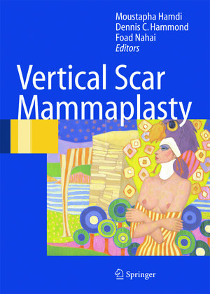 Buchcover Vertical Scar Mammaplasty  | EAN 9783540272182 | ISBN 3-540-27218-6 | ISBN 978-3-540-27218-2