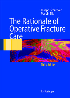 Buchcover The Rationale of Operative Fracture Care | Joseph Schatzker | EAN 9783540277088 | ISBN 3-540-27708-0 | ISBN 978-3-540-27708-8