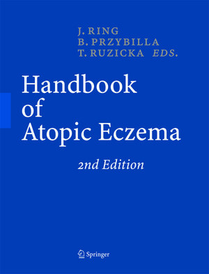 Buchcover Handbook of Atopic Eczema  | EAN 9783540298564 | ISBN 3-540-29856-8 | ISBN 978-3-540-29856-4
