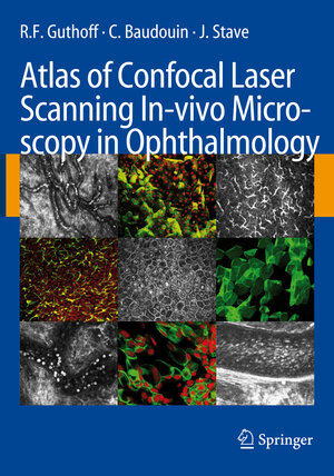 Buchcover Atlas of Confocal Laser Scanning In-vivo Microscopy in Ophthalmology | R.F. Guthoff | EAN 9783540327059 | ISBN 3-540-32705-3 | ISBN 978-3-540-32705-9