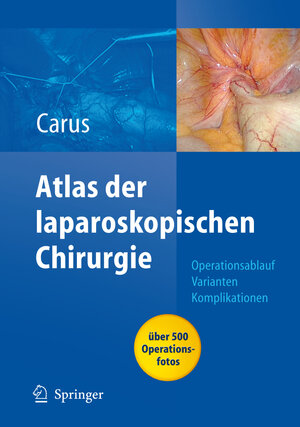 Buchcover Operationsatlas Laparoskopische Chirurgie | Thomas Carus | EAN 9783540336761 | ISBN 3-540-33676-1 | ISBN 978-3-540-33676-1