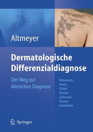 Buchcover Dermatologische Differenzialdiagnose | Peter Altmeyer | EAN 9783540390015 | ISBN 3-540-39001-4 | ISBN 978-3-540-39001-5