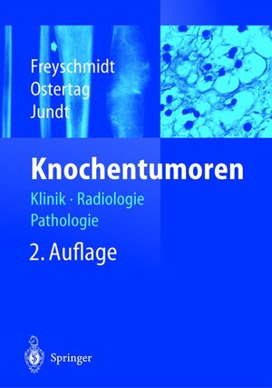 Knochentumoren : Klinik - Radiologie - Pathologie