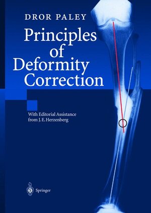 Buchcover Principles of Deformity Correction | Dror Paley | EAN 9783540416654 | ISBN 3-540-41665-X | ISBN 978-3-540-41665-4