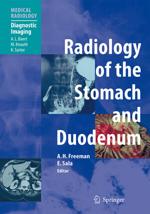 Buchcover Radiology of the Stomach and Duodenum | EAN 9783540424628 | ISBN 3-540-42462-8 | ISBN 978-3-540-42462-8