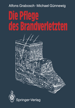 Die Pflege des Brandverletzten (German Edition)