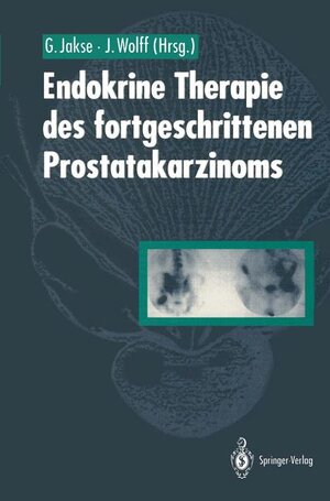 Buchcover Endokrine Therapie des fortgeschrittenen Prostatakarzinoms  | EAN 9783540544265 | ISBN 3-540-54426-7 | ISBN 978-3-540-54426-5
