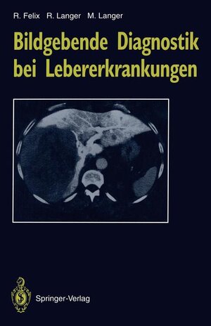Buchcover Bildgebende Diagnostik bei Lebererkrankungen | Roland Felix | EAN 9783540559337 | ISBN 3-540-55933-7 | ISBN 978-3-540-55933-7