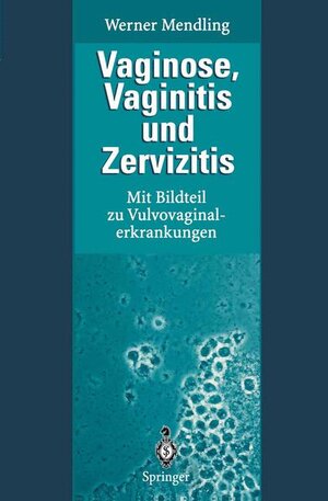 Buchcover Vaginose, Vaginitis und Zervizitis | Werner Mendling | EAN 9783540585534 | ISBN 3-540-58553-2 | ISBN 978-3-540-58553-4