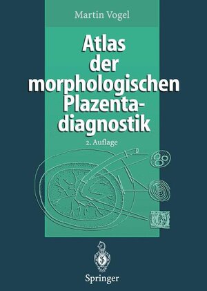 Buchcover Atlas der morphologischen Plazentadiagnostik | Martin Vogel | EAN 9783540607113 | ISBN 3-540-60711-0 | ISBN 978-3-540-60711-3