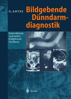 Buchcover Bildgebende Dünndarmdiagnostik | Günther Antes | EAN 9783540638377 | ISBN 3-540-63837-7 | ISBN 978-3-540-63837-7
