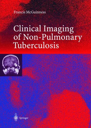 Buchcover Clinical Imaging in Non-Pulmonary Tuberculosis | Francis E. McGuinness | EAN 9783540659402 | ISBN 3-540-65940-4 | ISBN 978-3-540-65940-2