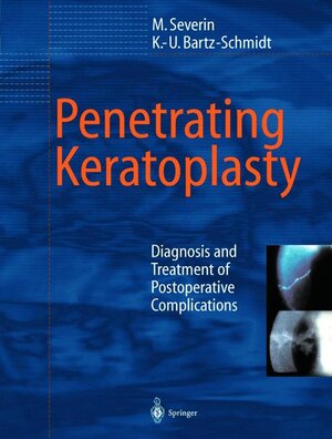 Buchcover Penetrating Keratoplasty | Maria Severin | EAN 9783540664918 | ISBN 3-540-66491-2 | ISBN 978-3-540-66491-8