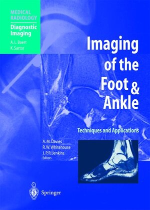 Buchcover Imaging of the Foot & Ankle  | EAN 9783540672944 | ISBN 3-540-67294-X | ISBN 978-3-540-67294-4