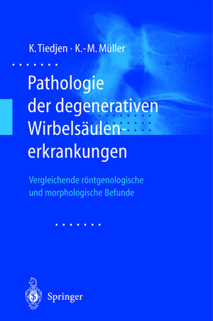 Buchcover Pathologie der degenerativen Wirbelsäulenerkrankungen | Kay Tiedjen | EAN 9783540677741 | ISBN 3-540-67774-7 | ISBN 978-3-540-67774-1