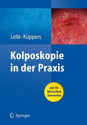 Buchcover Kolposkopie in der Praxis | Ralph J. Lellé | EAN 9783540783282 | ISBN 3-540-78328-8 | ISBN 978-3-540-78328-2
