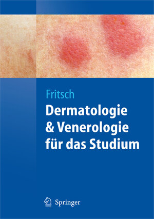 Buchcover Dermatologie und Venerologie für das Studium | Peter Fritsch | EAN 9783540793021 | ISBN 3-540-79302-X | ISBN 978-3-540-79302-1