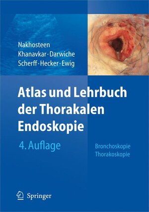 Buchcover Atlas und Lehrbuch der Thorakalen Endoskopie  | EAN 9783540799399 | ISBN 3-540-79939-7 | ISBN 978-3-540-79939-9