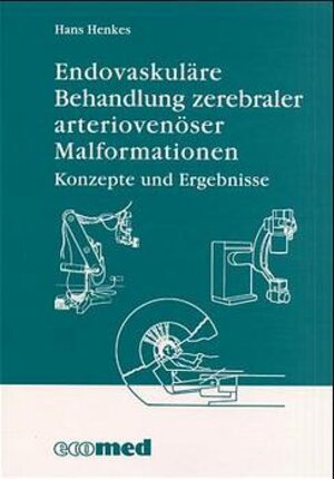 Endovaskuläre Behandlung zerebraler arterio-venöser Malformationen: Konzepte und Ergebnisse