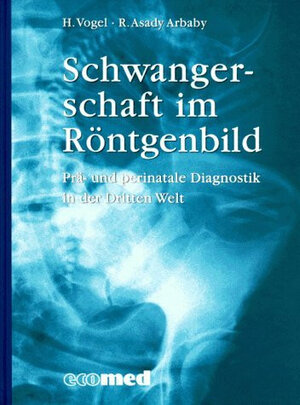 Schwangerschaft im Röntgenbild. Prä- und perinatale Diagnostik in der Dritten Welt