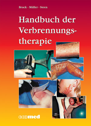 Handbuch der Verbrennungstherapie