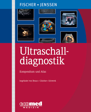 Buchcover Ultraschalldiagnostik | Thomas Fischer | EAN 9783609715803 | ISBN 3-609-71580-4 | ISBN 978-3-609-71580-3