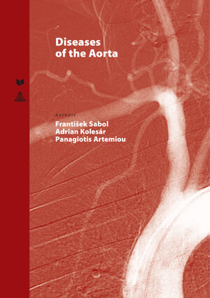 Buchcover Diseases of the Aorta  | EAN 9783631669174 | ISBN 3-631-66917-8 | ISBN 978-3-631-66917-4