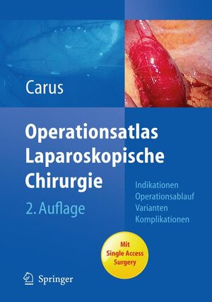 Buchcover Operationsatlas Laparoskopische Chirurgie | Thomas Carus | EAN 9783642017063 | ISBN 3-642-01706-1 | ISBN 978-3-642-01706-3