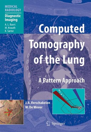 Buchcover Computed Tomography of the Lung | Johny A. Verschakelen | EAN 9783642065613 | ISBN 3-642-06561-9 | ISBN 978-3-642-06561-3