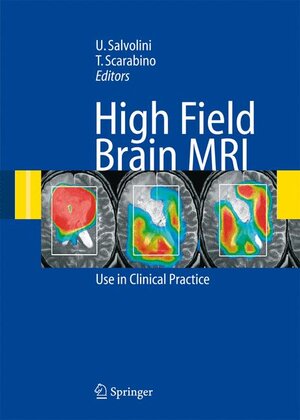 Buchcover High Field Brain MRI | EAN 9783642068669 | ISBN 3-642-06866-9 | ISBN 978-3-642-06866-9