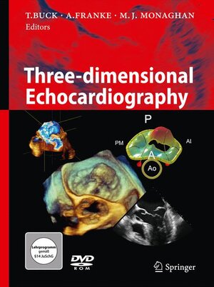 Buchcover Three-dimensional Echocardiography | EAN 9783642111785 | ISBN 3-642-11178-5 | ISBN 978-3-642-11178-5