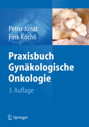 Buchcover Praxisbuch Gynäkologische Onkologie  | EAN 9783642170768 | ISBN 3-642-17076-5 | ISBN 978-3-642-17076-8