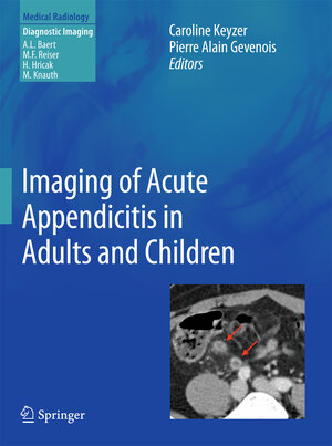 Buchcover Imaging of Acute Appendicitis in Adults and Children  | EAN 9783642178726 | ISBN 3-642-17872-3 | ISBN 978-3-642-17872-6