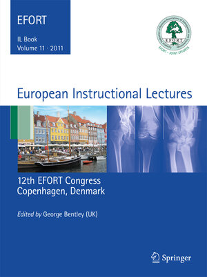 Buchcover European Instructional Lectures  | EAN 9783642183218 | ISBN 3-642-18321-2 | ISBN 978-3-642-18321-8