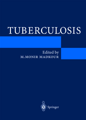 Buchcover Tuberculosis  | EAN 9783642189371 | ISBN 3-642-18937-7 | ISBN 978-3-642-18937-1