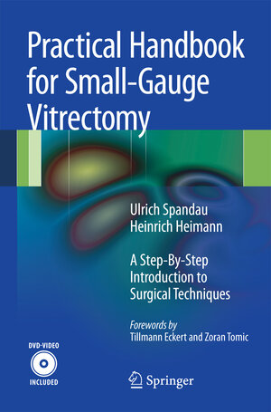 Buchcover Practical Handbook for Small-Gauge Vitrectomy | Ulrich Spandau | EAN 9783642232947 | ISBN 3-642-23294-9 | ISBN 978-3-642-23294-7