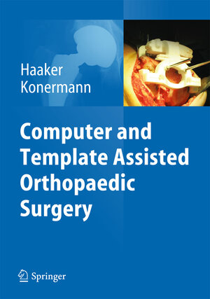 Buchcover Computer and Template Assisted Orthopedic Surgery  | EAN 9783642297281 | ISBN 3-642-29728-5 | ISBN 978-3-642-29728-1