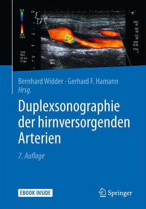 Buchcover Duplexsonographie der hirnversorgenden Arterien  | EAN 9783642298110 | ISBN 3-642-29811-7 | ISBN 978-3-642-29811-0