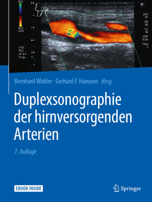 Buchcover Duplexsonographie der hirnversorgenden Arterien  | EAN 9783642298127 | ISBN 3-642-29812-5 | ISBN 978-3-642-29812-7