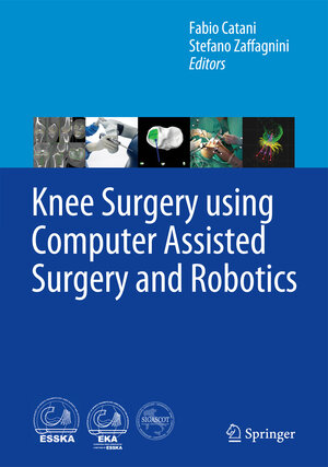 Buchcover Knee Surgery using Computer Assisted Surgery and Robotics | EAN 9783642314308 | ISBN 3-642-31430-9 | ISBN 978-3-642-31430-8