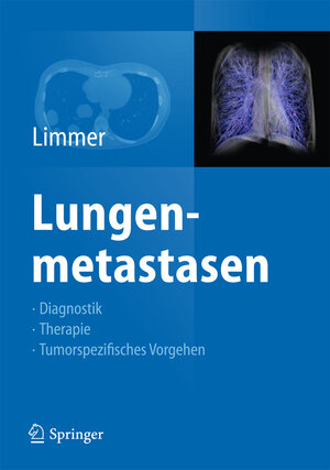 Buchcover Lungenmetastasen  | EAN 9783642329814 | ISBN 3-642-32981-0 | ISBN 978-3-642-32981-4