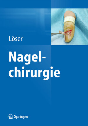 Buchcover Nagelchirurgie | Christoph Löser | EAN 9783642351877 | ISBN 3-642-35187-5 | ISBN 978-3-642-35187-7