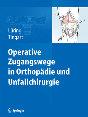 Buchcover Operative Zugangswege in Orthopädie und Unfallchirurgie  | EAN 9783642382659 | ISBN 3-642-38265-7 | ISBN 978-3-642-38265-9