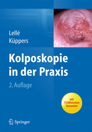 Buchcover Kolposkopie in der Praxis | Ralph J. Lellé | EAN 9783642383076 | ISBN 3-642-38307-6 | ISBN 978-3-642-38307-6