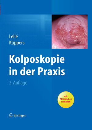 Buchcover Kolposkopie in der Praxis | Ralph J. Lellé | EAN 9783642383083 | ISBN 3-642-38308-4 | ISBN 978-3-642-38308-3