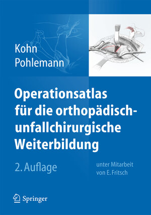 Buchcover Operationsatlas für die orthopädisch-unfallchirurgische Weiterbildung | Dieter Kohn | EAN 9783642384202 | ISBN 3-642-38420-X | ISBN 978-3-642-38420-2