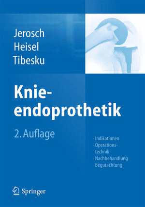 Buchcover Knieendoprothetik | Jörg Jerosch | EAN 9783642384226 | ISBN 3-642-38422-6 | ISBN 978-3-642-38422-6
