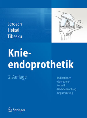 Buchcover Knieendoprothetik | Jörg Jerosch | EAN 9783642384233 | ISBN 3-642-38423-4 | ISBN 978-3-642-38423-3